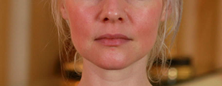 10 Facts About Sensitive Skin – Roman Skin & Body