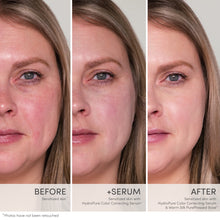 Load image into Gallery viewer, HydroPure™ Color Correcting Serum with Hyaluronic Acid &amp; CoQ10