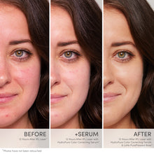 Load image into Gallery viewer, HydroPure™ Color Correcting Serum with Hyaluronic Acid &amp; CoQ10