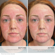 Load image into Gallery viewer, HydroPure™ Color Correcting Serum with Hyaluronic Acid &amp; CoQ10